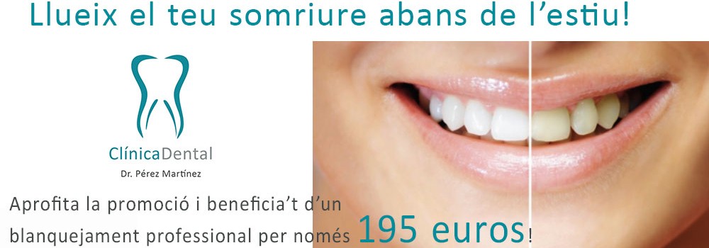 Un blanquejament dental professional per només 195€!